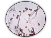 Endoconídeos de Ceratocystis paradoxa.